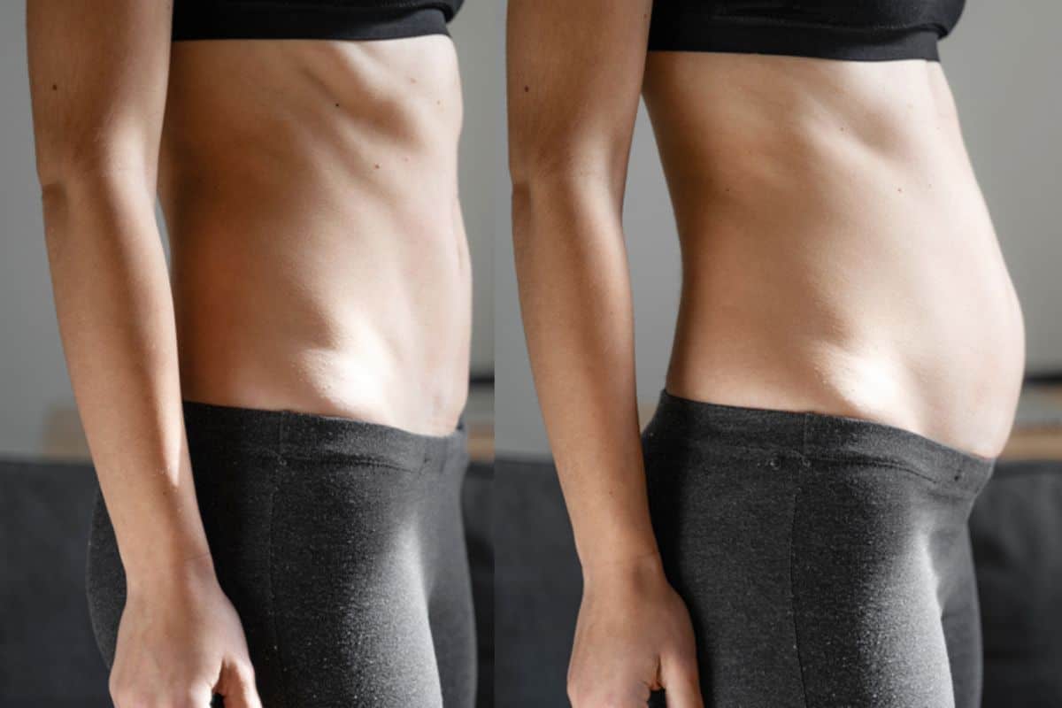 How long does diastasis recti take to improve Merseyside?