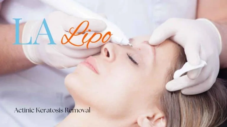 Woman receiving Actinic Keratosis Removal Treatment Merseyside