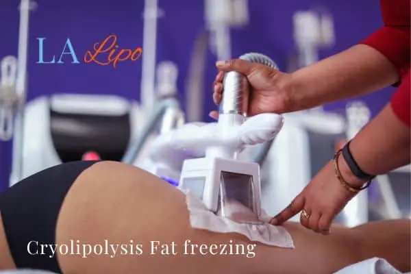 women getting fat freezing Merseyside