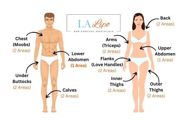 LA LIPO Cryolipolysis Areas Merseyside