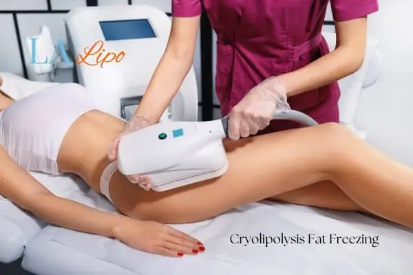 Woman receiving coolsculpting Merseyside treatment on her thighs