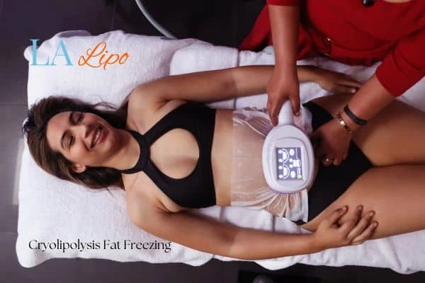 woman getting cryolipolysis Merseyside