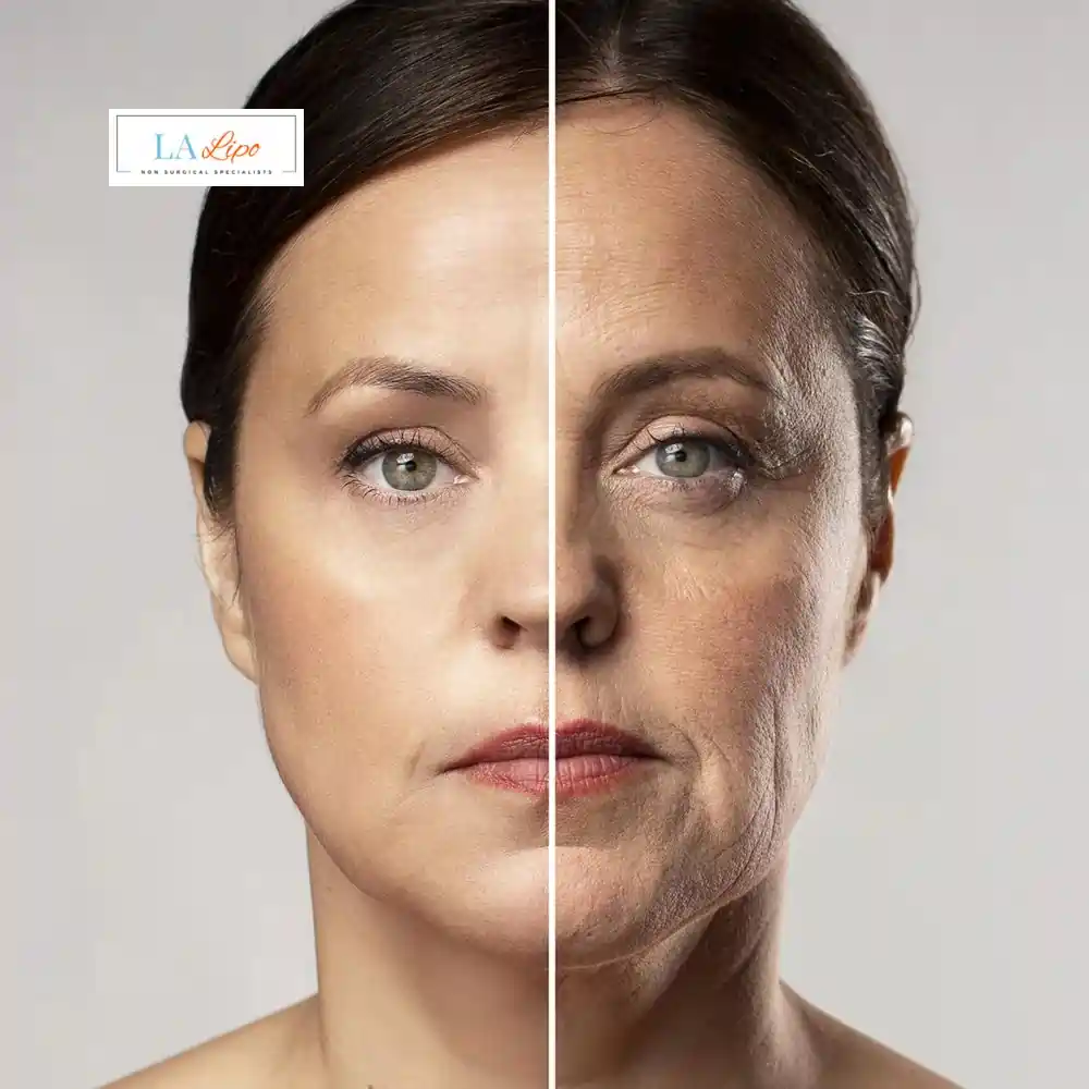 How Can You Tell If Non-Surgical Skin Tightening Is Right for You Merseyside?