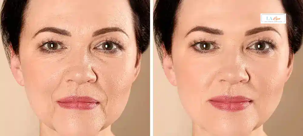 How Long Does It Take to See Results and How Long Do They Last Merseyside?