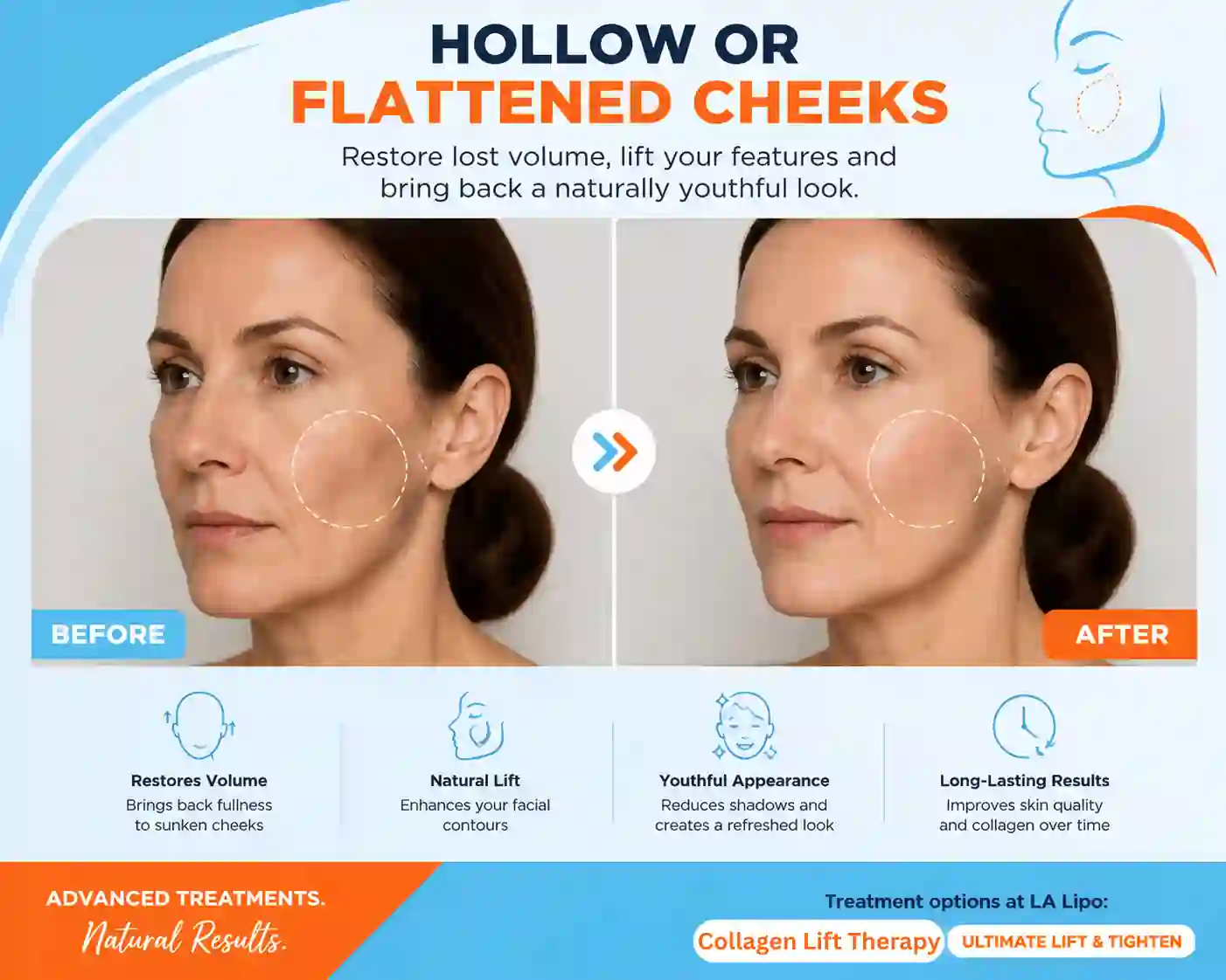 Sign #4: Hollow or Flattened Cheeks Merseyside