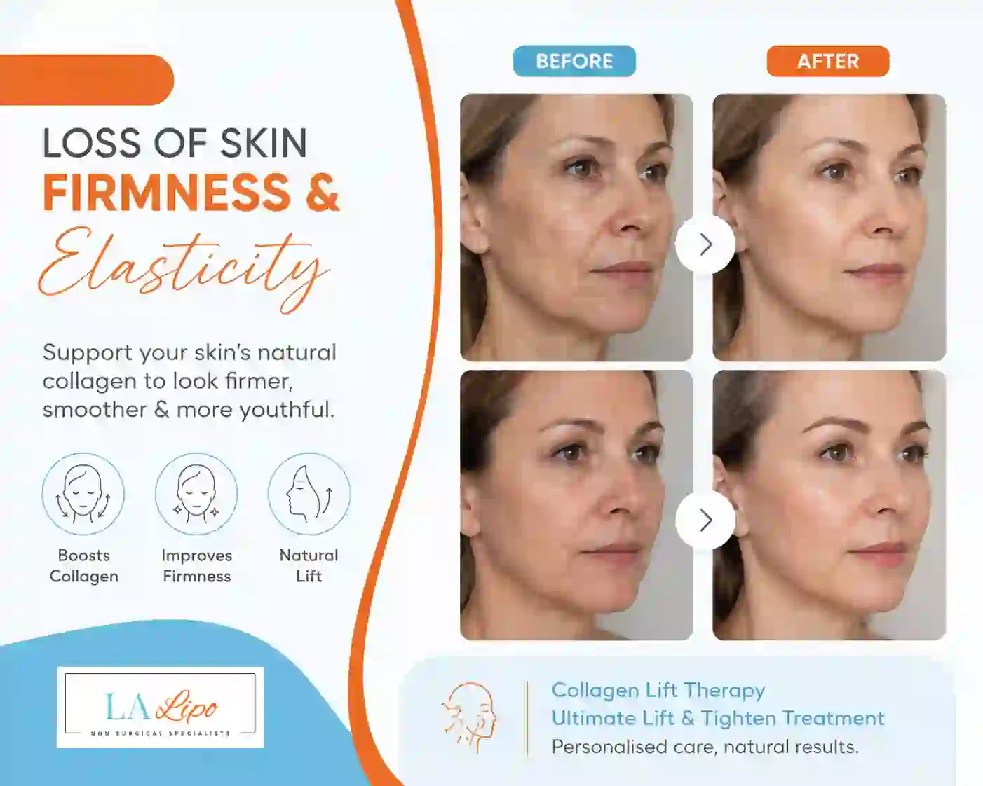 Sign #7: Loss of Skin Firmness and Elasticity Merseyside