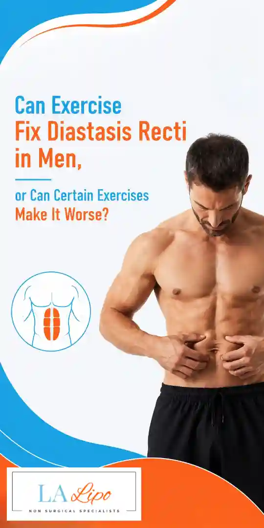 Can Exercise Fix Diastasis Recti in Men, or Can Certain Exercises Make It Worse Merseyside?